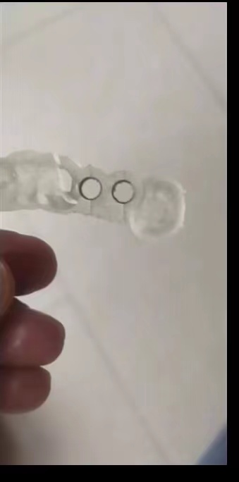 Hars Tandheelkundige 3D-printe - 3D Printing Uv Resin recensie en prijs